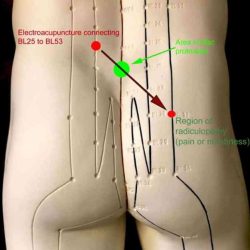 Yao yang guan acupuncture point