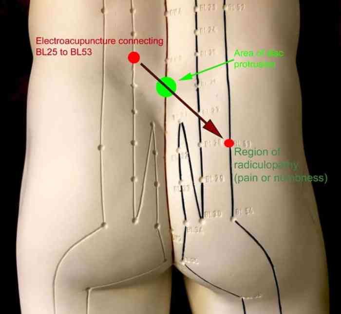 Yao yang guan acupuncture point